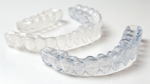 Clear Teeth Aligners in Pakenham